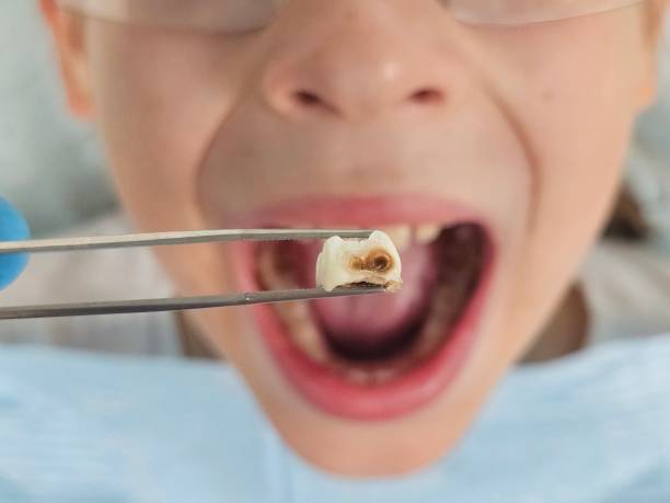 Best Tooth Pain Emergency Relief  in Lake Junaluska, NC